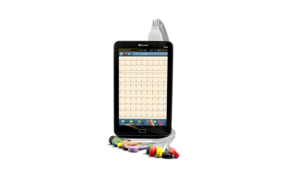 Mobile ECG Monitor 