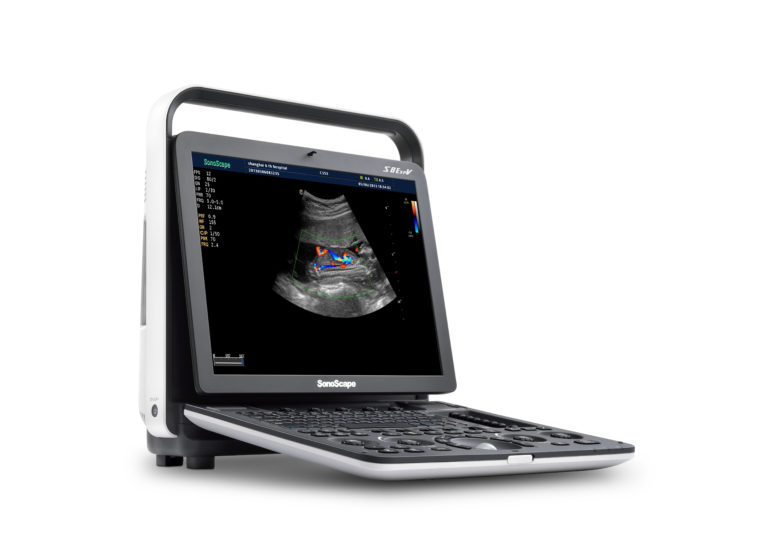 Color Doppler Ultrasound  Portable Systems 