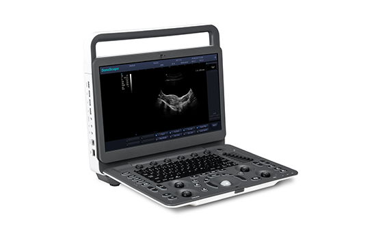 Color Doppler Ultrasound  Portable Systems 