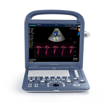 Color Doppler Ultrasound  Portable Systems 