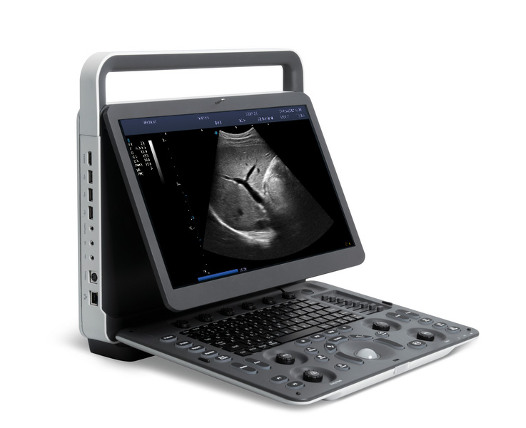 Color Doppler Ultrasound  Portable Systems 
