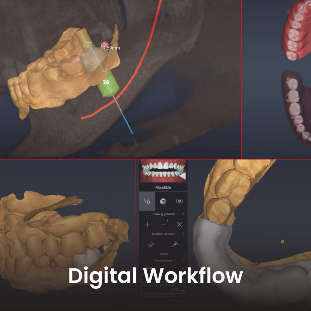 Dental Digital Workflow Solution