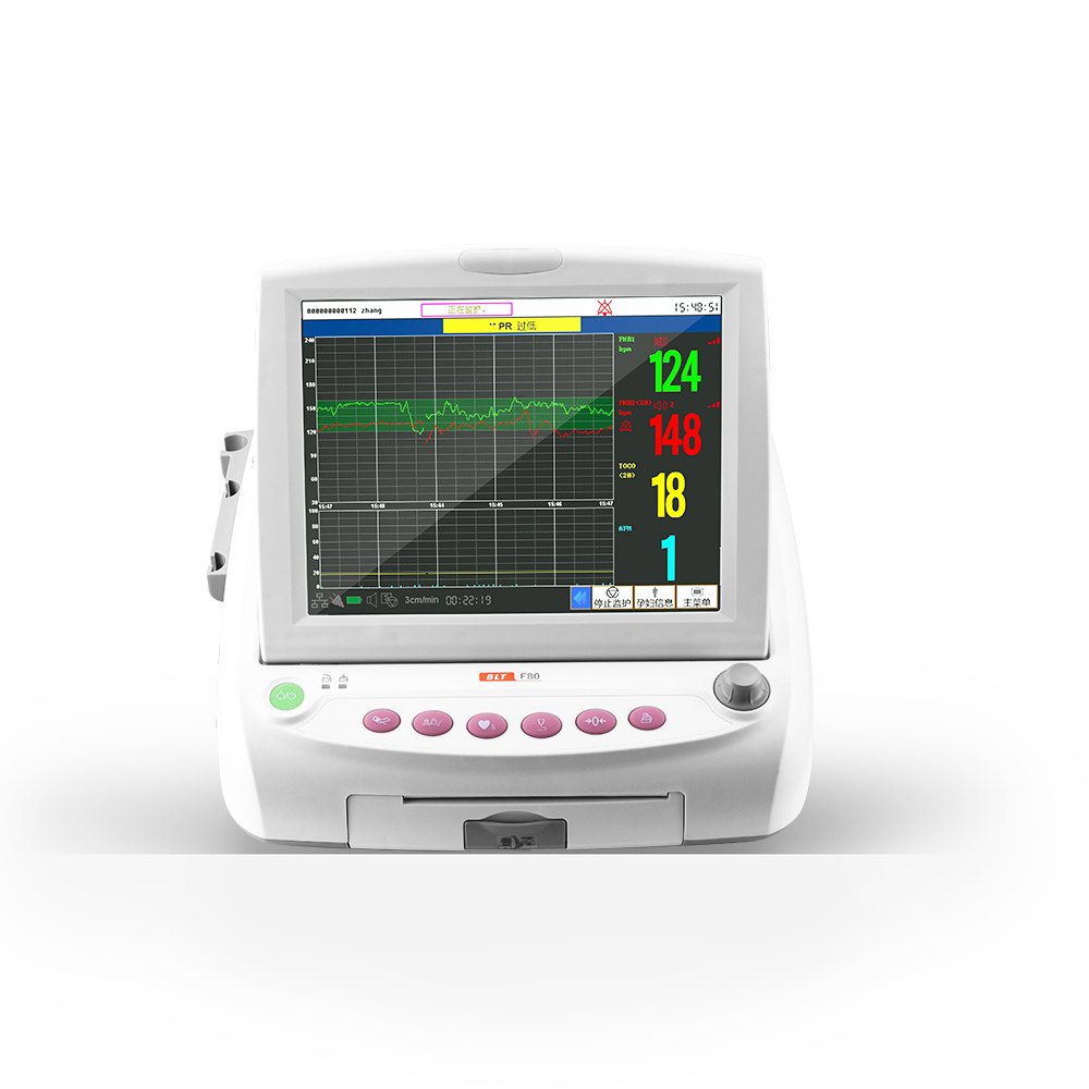 Fetal Monitor 12 inch - FHR1