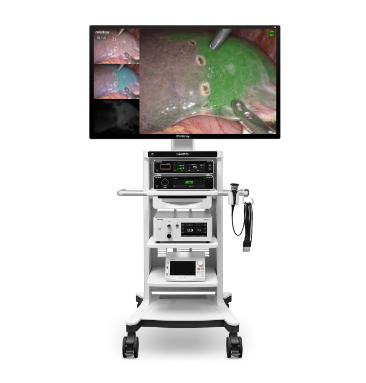 Endoscope Camera System