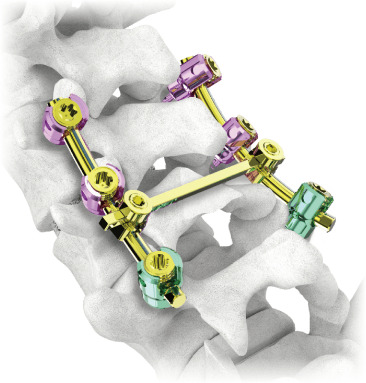 Spine Comprehensive Solutions