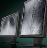 Virtual Grid for Intelligent image processing 