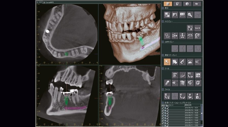 Dental Imaging Software