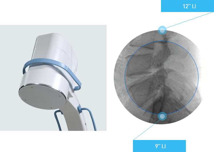 Mobile C-Arm X-ray system 