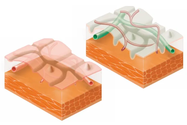 Virtual Chromoendoscopy