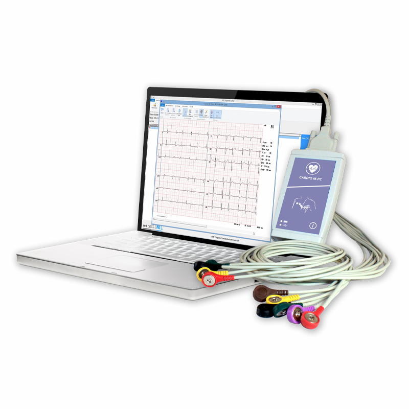 12-channel rest ECG