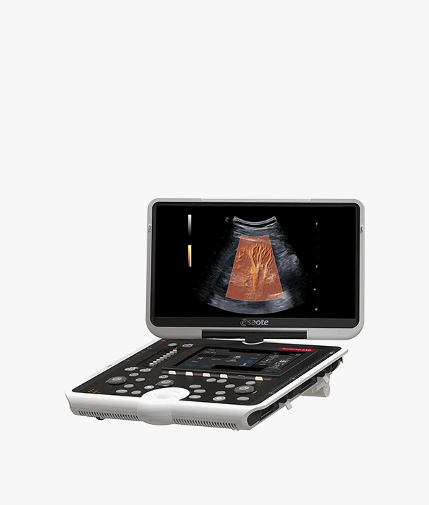 Portable Ultrasound System