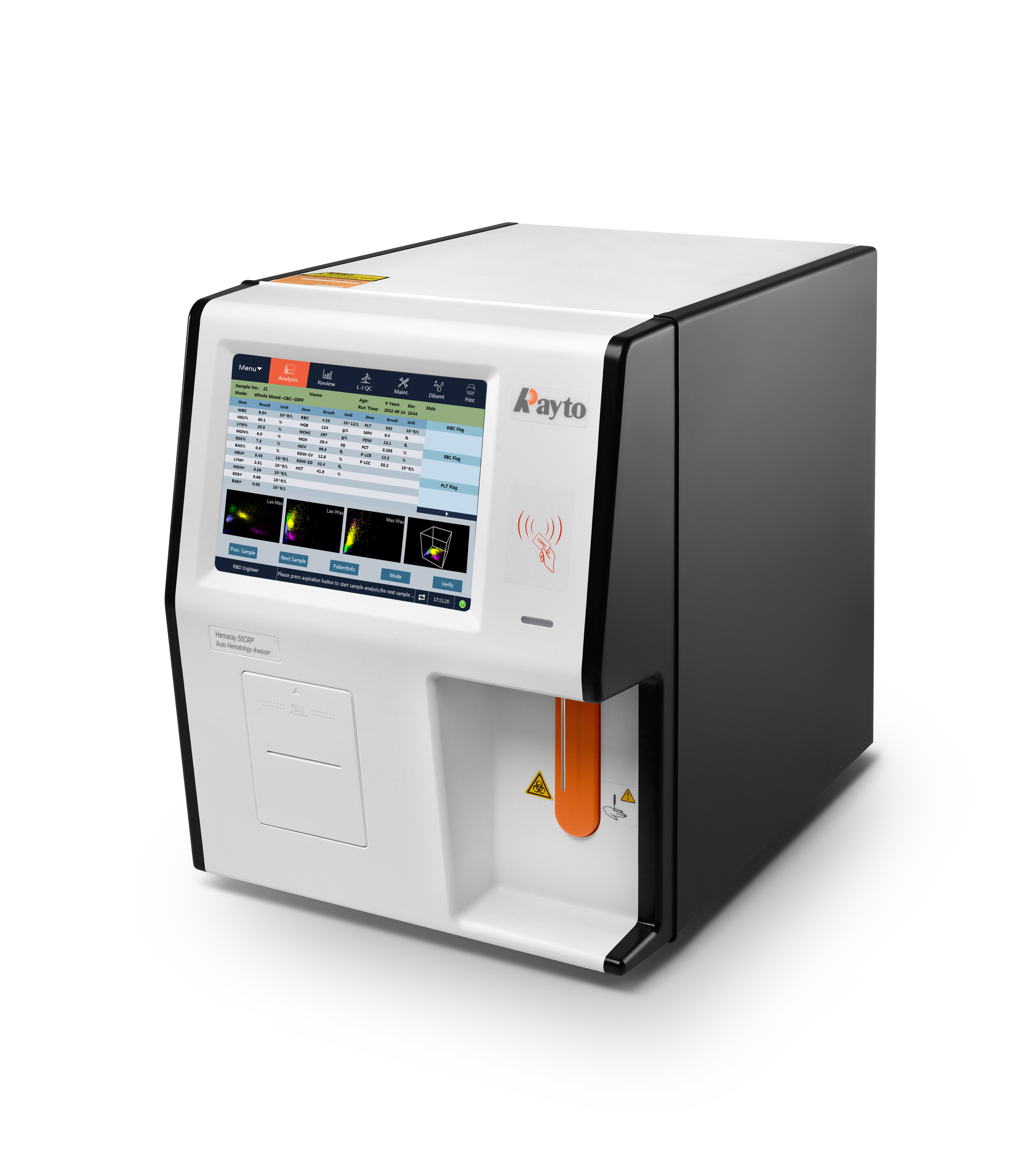 5-part Differential Auto Hematology Analyzer