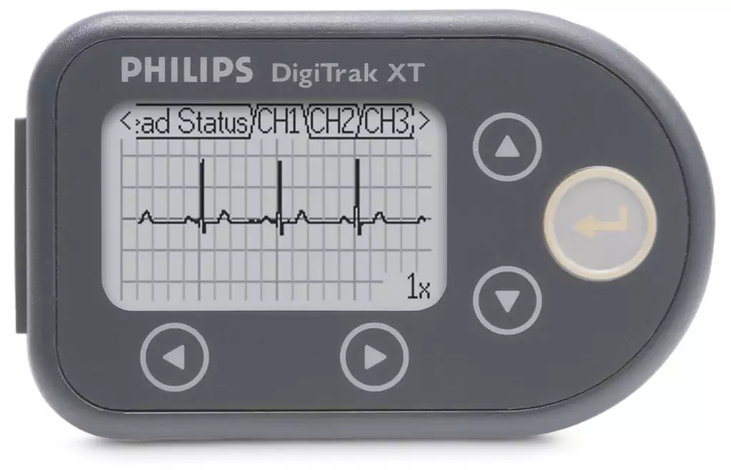 Holter monitoring