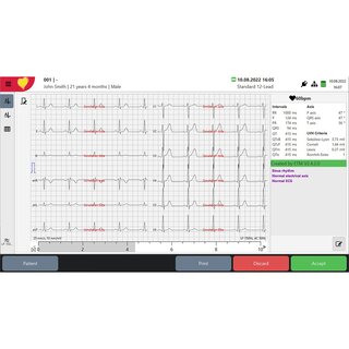 ECG analysis program