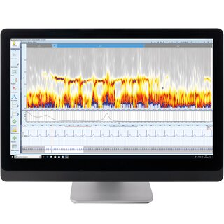 Heart rate variability (HRV) and the autonomic nervous system