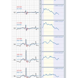 Non-invasive diagnosis of ischaemic heart disease